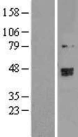Novus Biologicals™ TRMT2B Overexpression Lysate