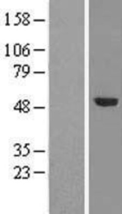 Novus Biologicals™ TRMT5 Overexpression Lysate