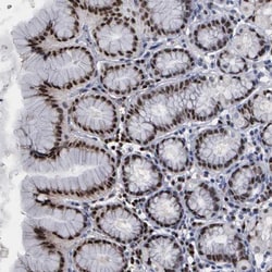 TRMT5 Antibody, Novus Biologicals 25 &mu;L; Unlabeled:Antibodies, Polyclonal