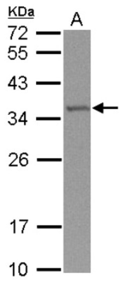 TRMT61A Antibody, Novus Biologicals 0.1mL; Unlabeled:Antibodies, Polyclonal