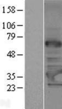 Novus Biologicals™ TRMT61A Overexpression Lysate