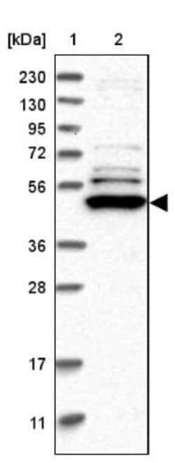 TRMT61B Antibody, Novus Biologicals 25 &mu;L; Unlabeled:Antibodies, Polyclonal