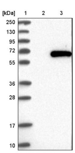 TRMT61B Antibody, Novus Biologicals:Antibodies:Primary Antibodies