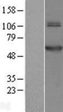 Novus Biologicals™ TRMT61B Overexpression Lysate