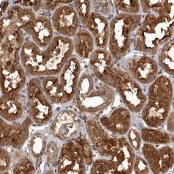 TRMT61B Antibody, Novus Biologicals:Antibodies:Primary Antibodies