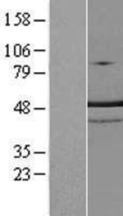 Novus Biologicals&trade;&nbsp;TRNT1 Overexpression Lysate