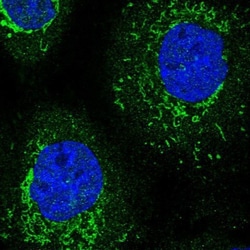 CENPP Antibody, Novus Biologicals:Antibodies:Primary Antibodies