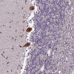 TROAP Antibody, Novus Biologicals 25 &mu;L, Unlabeled:Antibodies, Polyclonal