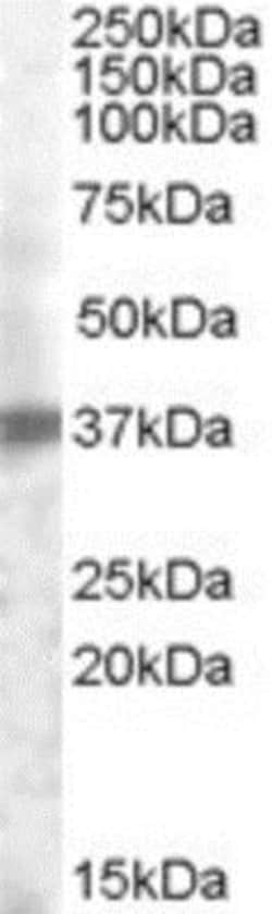 TROP-2 Antibody, Novus Biologicals 0.1mg; Unlabeled:Antibodies, Polyclonal