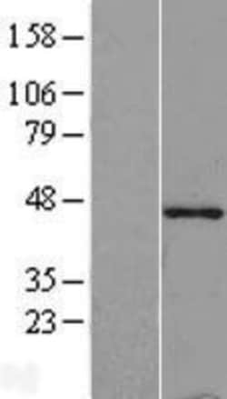 Novus Biologicals&trade;&nbsp;Tropomodulin 1 Overexpression Lysate