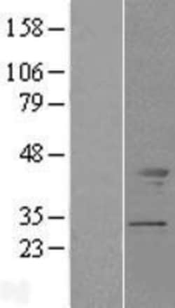 Novus Biologicals™ Tropomodulin 2 Overexpression Lysate