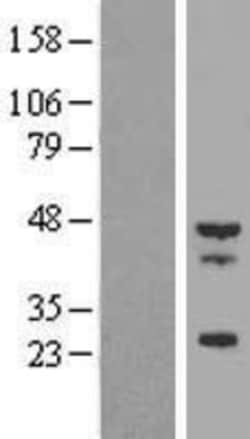 Novus Biologicals™ Tropomodulin 4 Overexpression Lysate