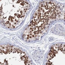 Tropomodulin 2 Antibody, Novus Biologicals 0.1mL; Unlabeled:Antibodies,