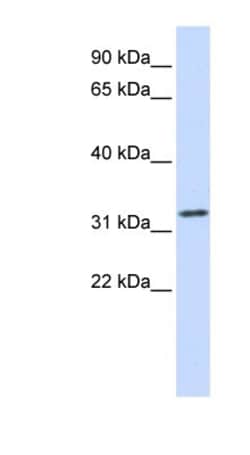 Tropomyosin-1 Antibody, Novus Biologicals:Antibodies:Primary Antibodies