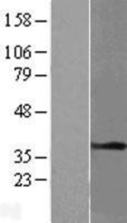 Novus Biologicals&trade;&nbsp;Tropomyosin-1 Overexpression Lysate
