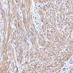 Tropomyosin-1 Antibody, Novus Biologicals:Antibodies:Primary Antibodies