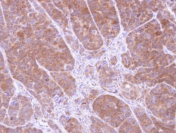 tropomyosin-2 Antibody, Novus Biologicals 0.1mL; Unlabeled:Antibodies,