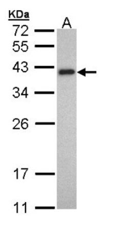 tropomyosin-2 Antibody, Novus Biologicals 0.1mL; Unlabeled:Antibodies,