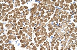 tropomyosin-2 Antibody, Novus Biologicals 0.1mg; Unlabeled:Antibodies,