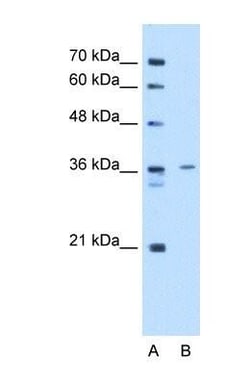 tropomyosin-2 Antibody, Novus Biologicals 0.1mg; Unlabeled:Antibodies,