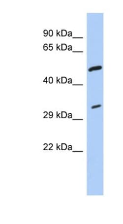 tropomyosin-3 Antibody, Novus Biologicals 0.05mg; Unlabeled:Antibodies,