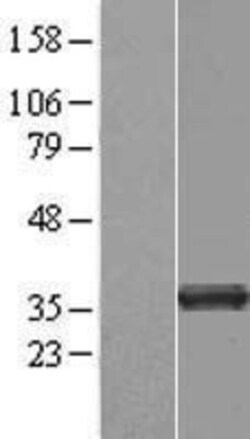 Novus Biologicals™ tropomyosin-3 Overexpression Lysate