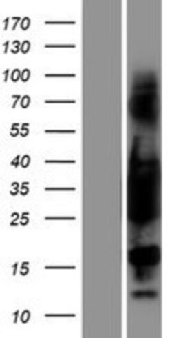 Novus Biologicals™ tropomyosin-3 Overexpression Lysate