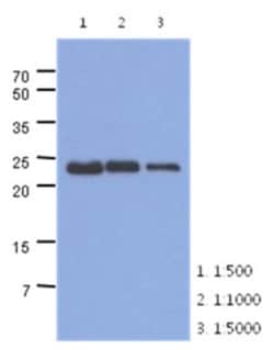 Troponin I Type 1 (slow skeletal) Antibody (36E7) - BSA Free, Novus Biologicals 50 ul | Buy Online | Bio-Techne | Fisher Scientific