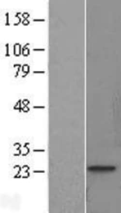 Novus Biologicals™ Troponin I Type 1 (slow skeletal) Overexpression Lysate
