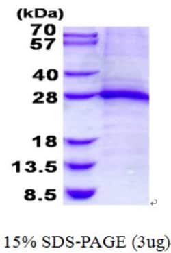 Novus Biologicals&trade;&nbsp;Recombinant Human Troponin I Type 1 (slow skeletal) His Protein