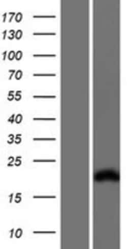 Novus Biologicals&trade;&nbsp;Troponin I type 2 (fast skeletal) Overexpression Lysate