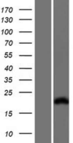 Novus Biologicals&trade;&nbsp;Troponin I type 2 (fast skeletal) Overexpression Lysate