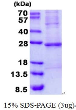 Novus Biologicals&trade;&nbsp;Recombinant Human Troponin I type 2 (fast skeletal) His Protein