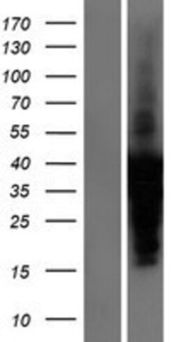 Novus Biologicals™ Troponin I Type 3 (cardiac) Overexpression Lysate