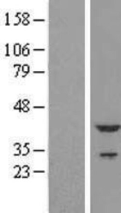 Novus Biologicals&trade;&nbsp;Troponin T Type 2 (cardiac) Overexpression Lysate