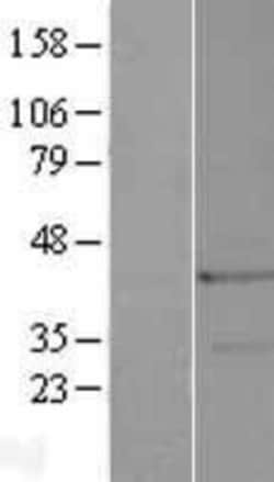 Novus Biologicals&trade;&nbsp;Troponin T Type 3 (fast skeletal) Overexpression Lysate