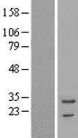 Novus Biologicals&trade;&nbsp;Troponin T Type 3 (fast skeletal) Overexpression Lysate