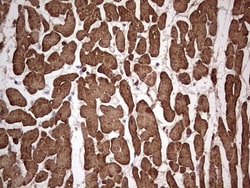 Troponin C (cardiac) Antibody (OTI5H3), Novus Biologicals 0.1mL; Unlabeled:Antibodies,