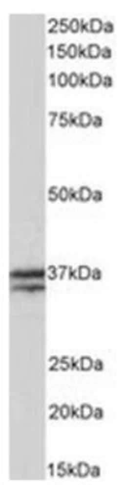 Troponin T type 1 (slow skeletal) Antibody, Novus Biologicals 0.1mg; Unlabeled:Antibodies,