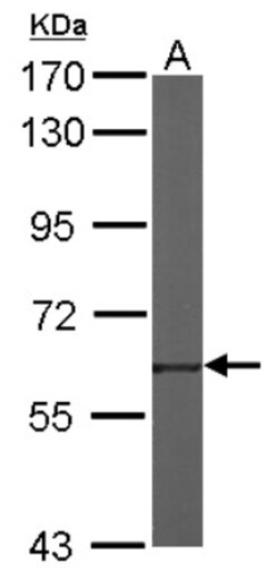 TROVE2 Antibody, Novus Biologicals 0.1mL; Unlabeled:Antibodies, Polyclonal