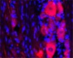 TRPC1 Antibody, Novus Biologicals:Antibodies:Primary Antibodies