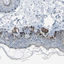 Tyrosylprotein Sulfotransferase 2/TPST2 Antibody, Novus Biologicals:Antibodies:Primary