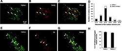 TRPA1 Antibody, Novus Biologicals 0.1 mL; Unconjugated:Antibodies, Polyclonal