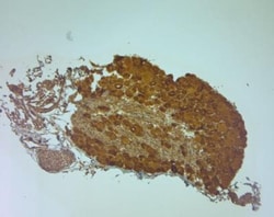 TRPA1 Antibody, Novus Biologicals 0.025 mL; Unconjugated:Antibodies, Polyclonal