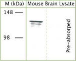 TRPA1 Antibody, Novus Biologicals 0.025 mL; Unconjugated:Antibodies, Polyclonal