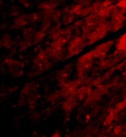 TRPC3 Antibody - BSA Free, Novus Biologicals 0.1mg; Unlabeled:Antibodies,