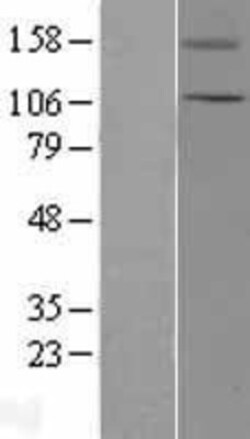 Novus Biologicals™ TRPC5 Overexpression Lysate