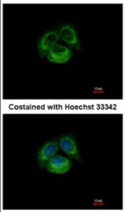 TRPC6 Antibody, Novus Biologicals 0.1mL; Unlabeled:Antibodies, Polyclonal