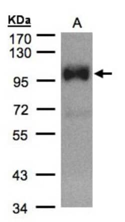 TRPC6 Antibody, Novus Biologicals 0.1mg; Unlabeled:Antibodies, Polyclonal