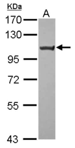 TRPC6 Antibody, Novus Biologicals 0.1mL; Unlabeled:Antibodies, Polyclonal